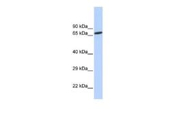 ZNF571 Antibody, Novus Biologicals 100 &mu;L | Buy Online | Novus Biologicals | Fisher Scientific